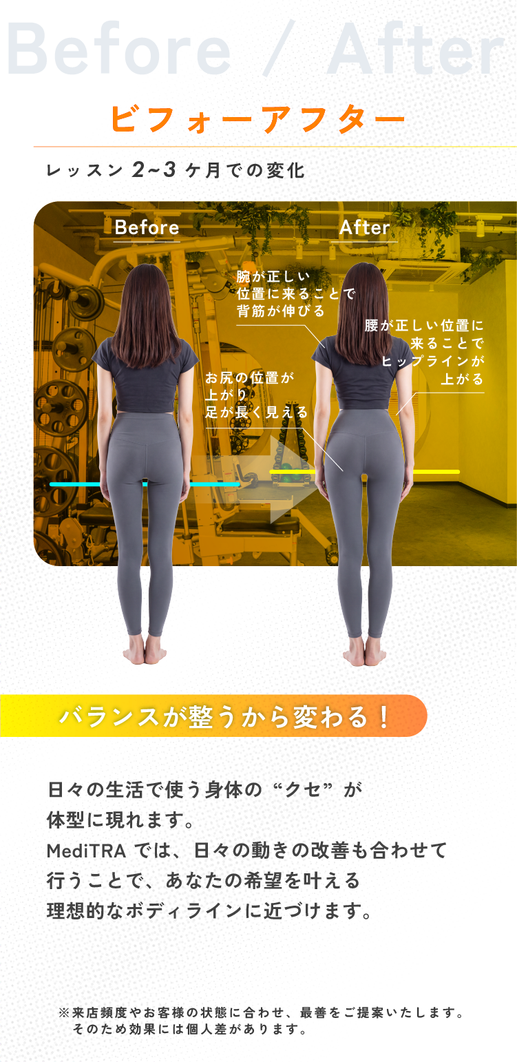 beforeafter